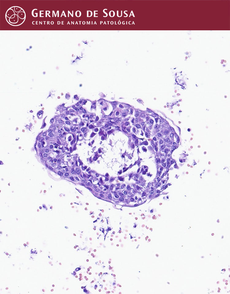 Citopatologia