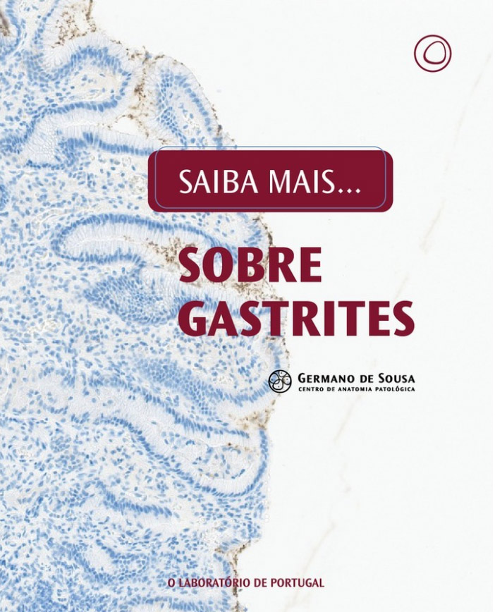 Sobre gastrites