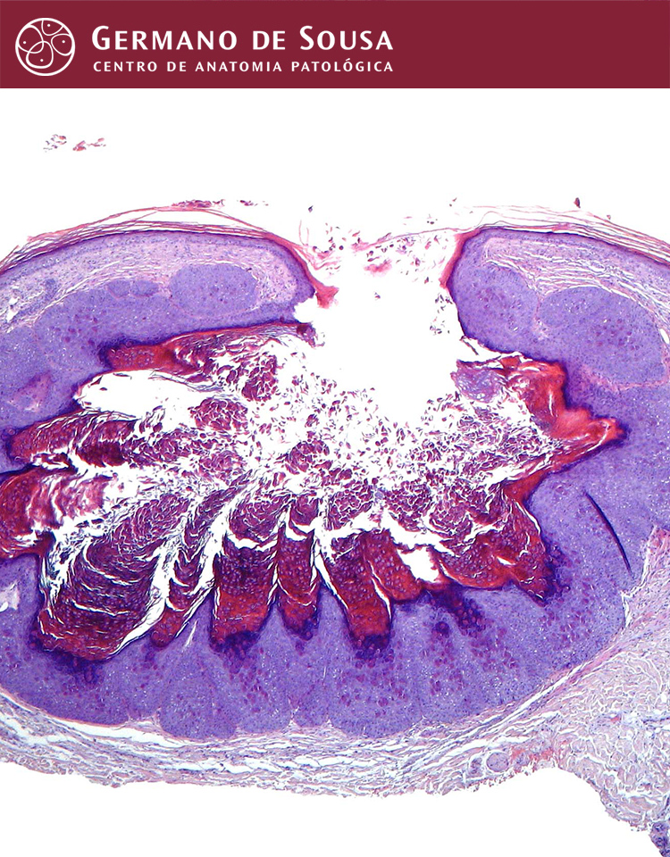 Dermatopatologia