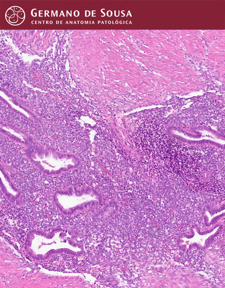 Patologia Ginecológica
