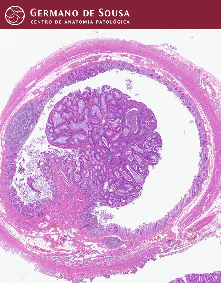 Patologia Gastrointestinal